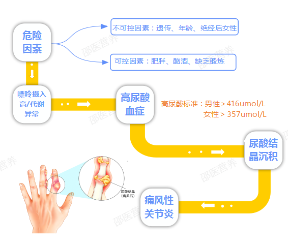 痛風(fēng)為什么偏愛男性？你最關(guān)心的問題都在這里