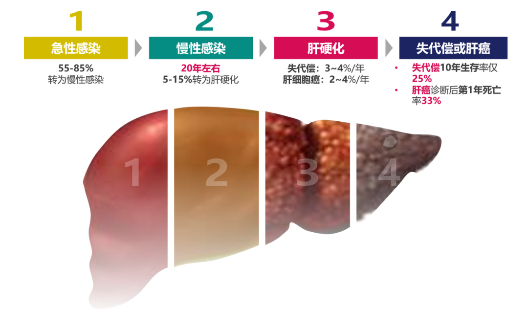 悄悄變成肝硬化、肝癌，很多人感染了卻不知道