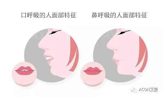 過敏性鼻炎會(huì)讓孩子變傻？！家長該如何應(yīng)對(duì)